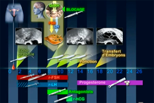 This image for Image Layouts addon