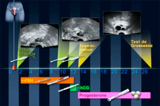 This image for Image Layouts addon